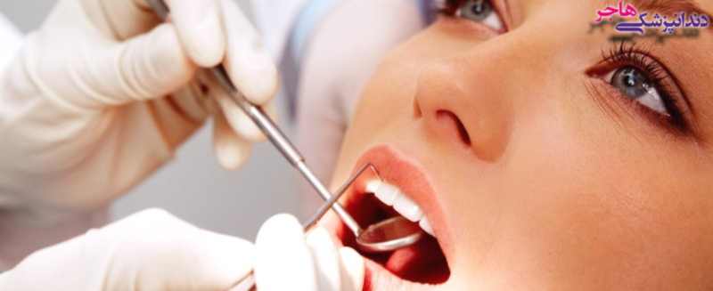 تراشیدن دندان در جرمگیری حس بدی ایجاد می کند